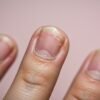 Damaged Nail