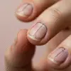 black lines on nails